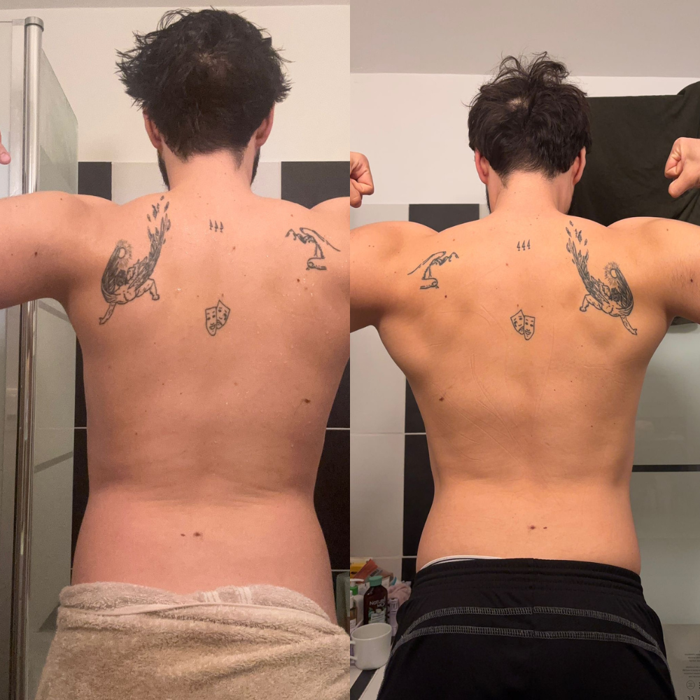 Anthony Transformation